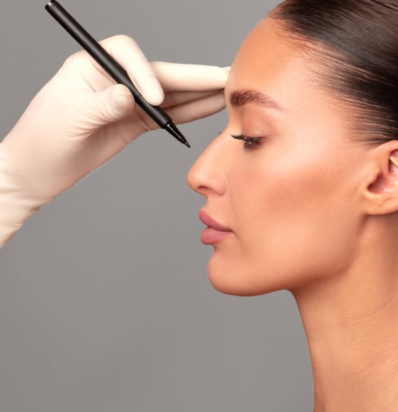 Rinoplastia Rinoplastia