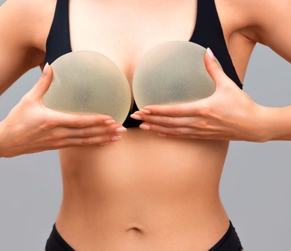 Breast implant Breast implant