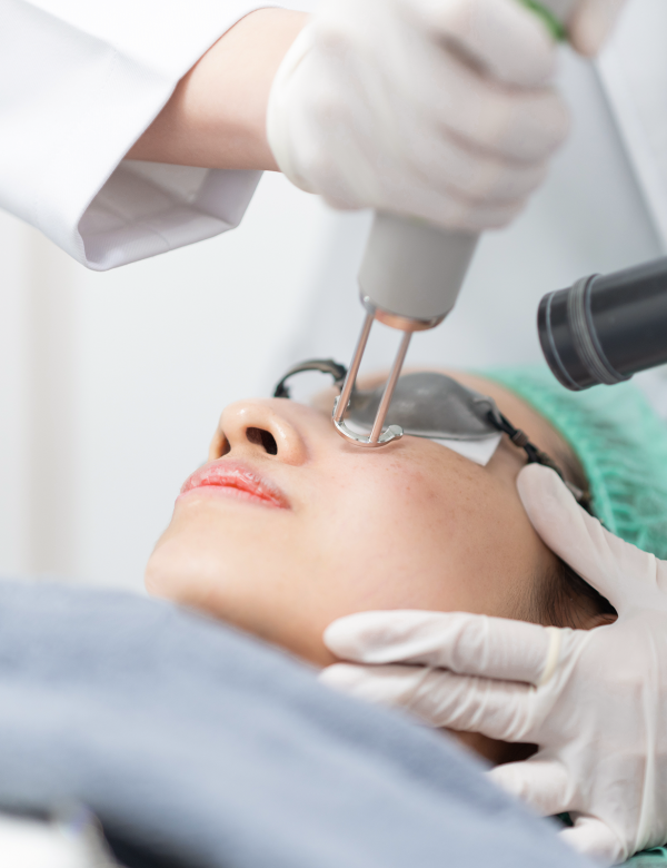 Laser treatment Laser treatment