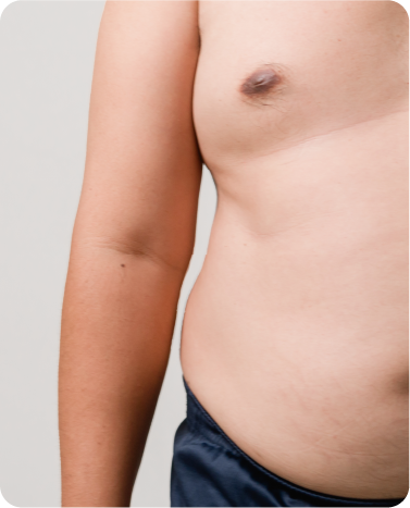Ideal Weight Loss